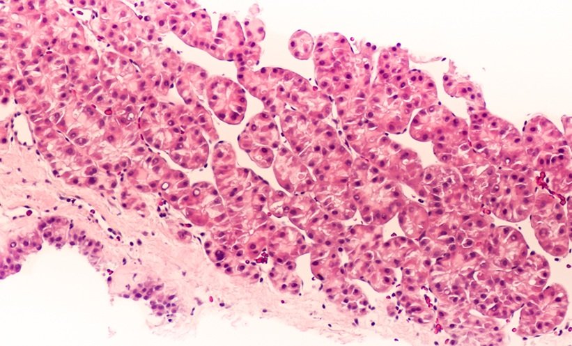 AKAP1 Metabolic Pathway Drives Liver Cancer Growth