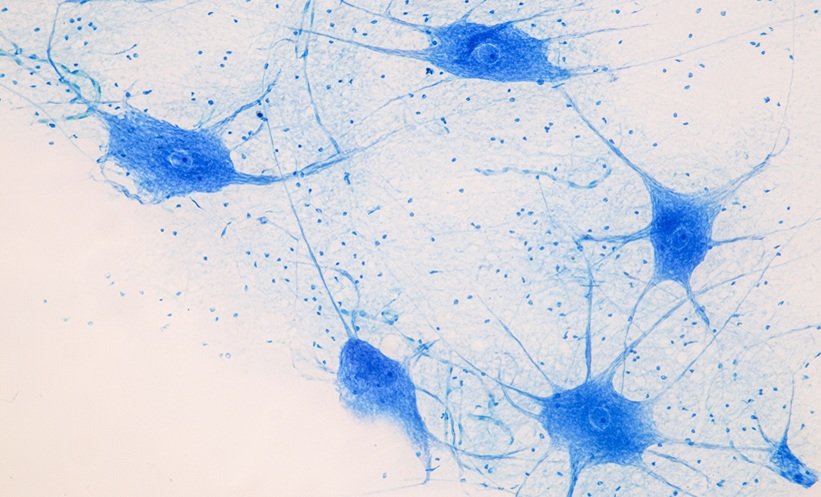 New Mechanism for Gene Therapy Brain Delivery