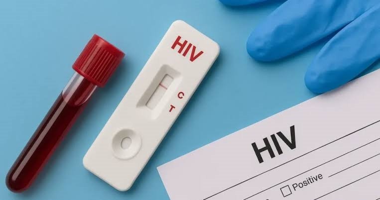 Caribbean backs new political declaration on HIV