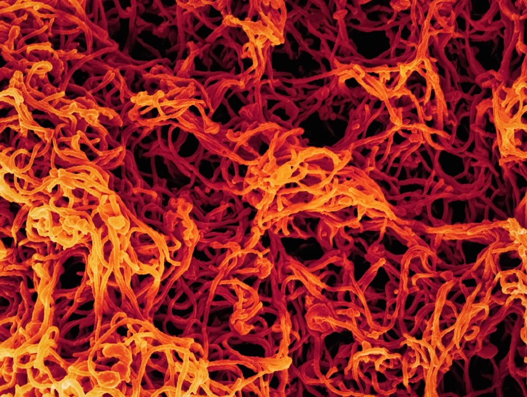 Congo Ebola outbreak update – by Robert Herriman