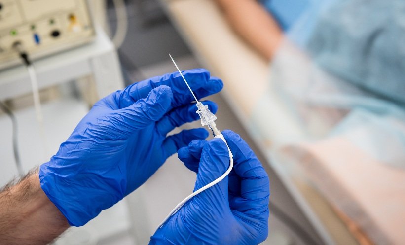 Microwave Ablation for Papillary Thyroid Cancer