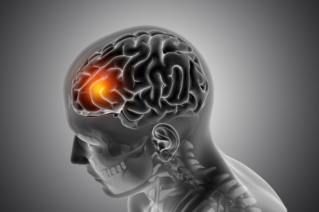 London Surgeons Use AI in World-First Live-Assisted Brain Tumour Surgery
